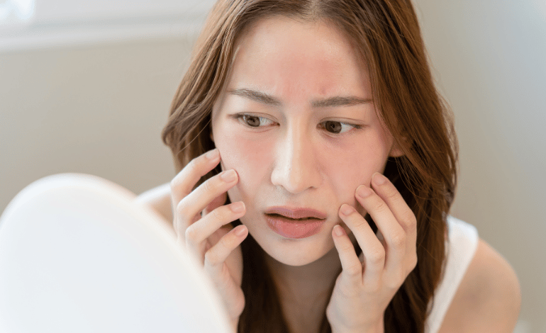 Dry and Sensitive Skin: Understanding Causes and Care